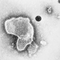 Strong RSV Vaccine Data Lifts Hopes After Years of Futility