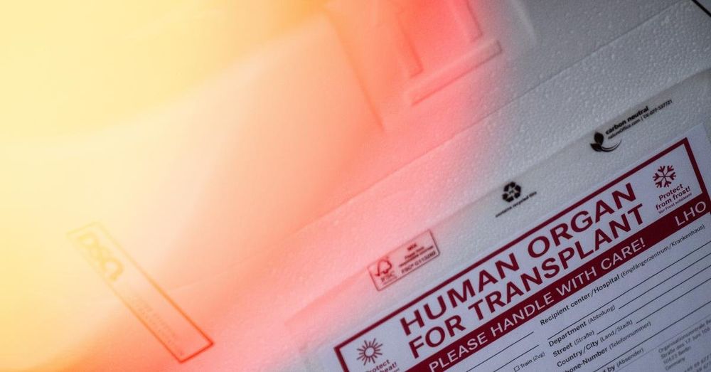 With $1M per body in play, some in Congress asking if organ donors are declared dead too quickly