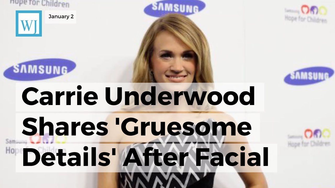 Carrie Underwood Shares ‘Gruesome Details’ After Facial Injury ‘Between 40 and 50 Stitches’