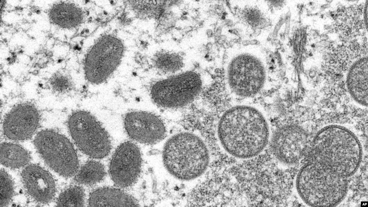 US Expanding Monkeypox Testing