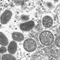 US Expanding Monkeypox Testing