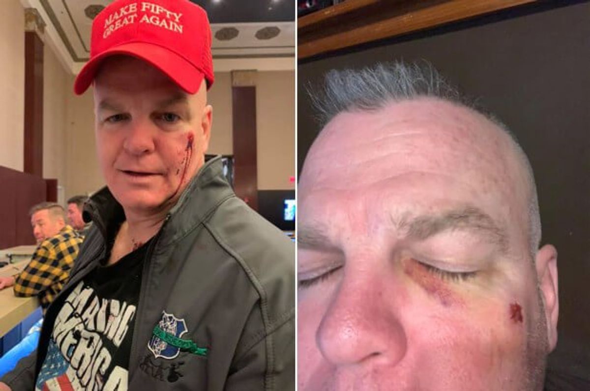 Leftist Slaps Juvenile Over Trump Support; Woman Triggered by Red Punches Retired Cop Same Reason