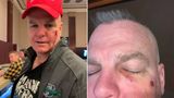 Leftist Slaps Juvenile Over Trump Support; Woman Triggered by Red Punches Retired Cop Same Reason