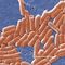 CDC warns of antibiotic-resistant salmonella