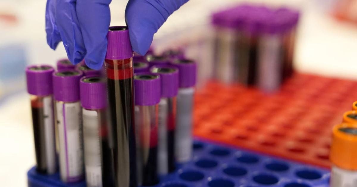 Columbia University claims possible breakthrough in blood revitalization, cold 'delay aging' - Real America's Voice News