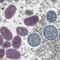 World Health Organization declares monkeypox a global public health emergency