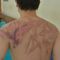 Hong Kong Subway Attack Victim Shows Bruises