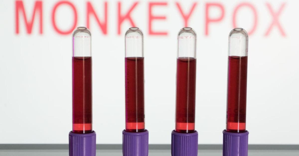 WHO to decide whether to elevate monkeypox to 'public health emergency of international concern' - Real America's Voice News