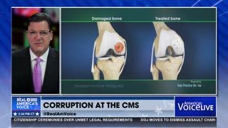 CMS PICKING WINNERS IN WOUND CARE?