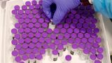 Hospital denies kidney transplant to unvaccinated woman: Report