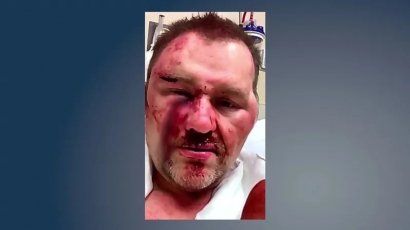 Photo provided by Achille Mayor David Northcutt after attack at a convenience store in March 2019. 