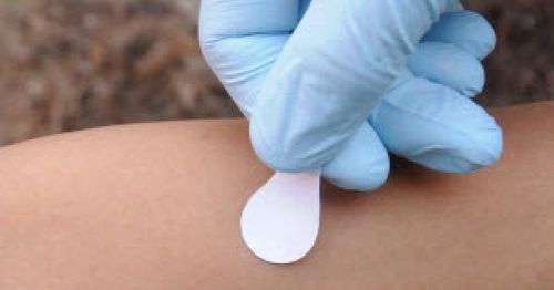COVID 'patch' vaccine trial launched by Swiss researchers