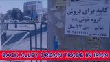 Back Alley Organ Trade in Iran