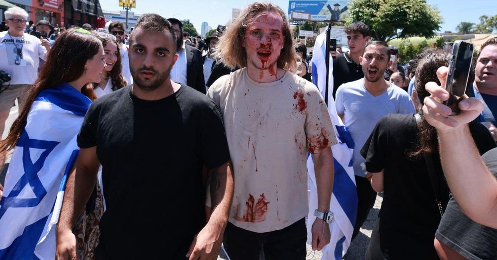 Alarm raised over ‘pogrom’ in LA after anti-Israel protest at synagogue turns violent