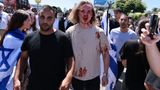 Alarm raised over ‘pogrom’ in LA after anti-Israel protest at synagogue turns violent