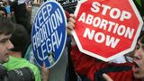 South Carolina House passes bill that would prohibit most abortions if a fetal heartbeat is detected