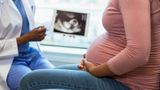 Louisiana representatives advance bill to classify abortion as homicide
