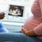 Florida Republicans file legislation to ban abortion after 6 weeks