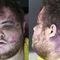 Colorado Springs gay club shooting suspect charged with murder, hate crimes