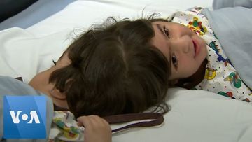 Twins Conjoined at the Head Undergo Successful Surgery in Britain