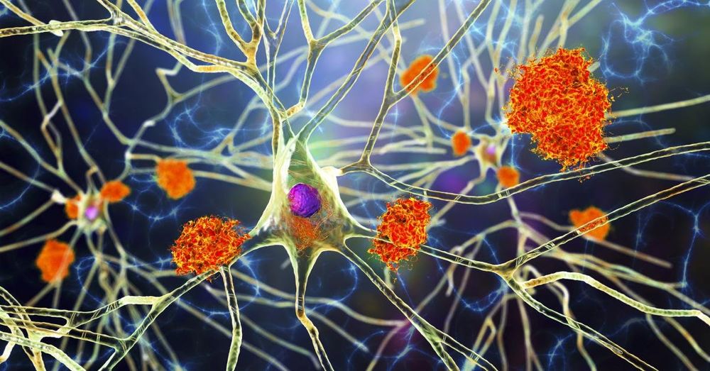 New blood test for Alzheimer's disease gets FDA approval