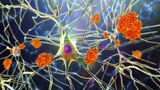 Scientists claim major discovery of mechanics of Alzheimer’s progression in brain